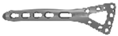 Запирающая пластина дорсальной стороны дистальной лучевой кости