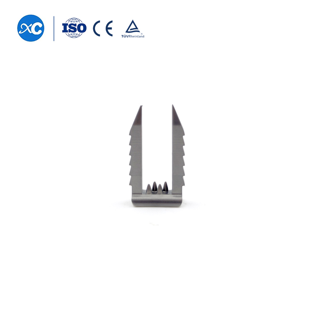 Степлерная система для фиксации связок – реконструкция передней крестообразной связки