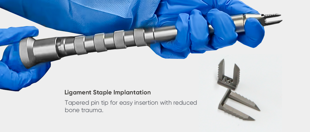 | Фиксация мягких тканей для реконструкции передней крестообразной связки | Скоба для связок XC Medico, спортивная медицина 