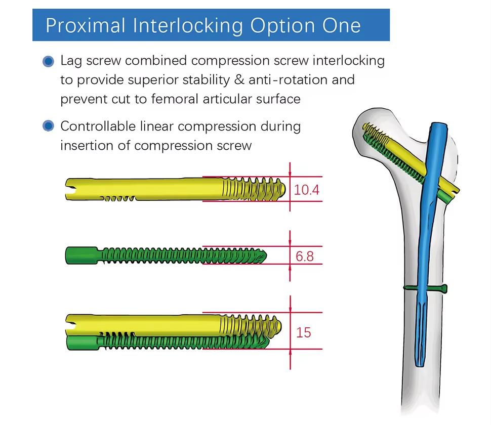 Бедренный интрамедуллярный стержень-2