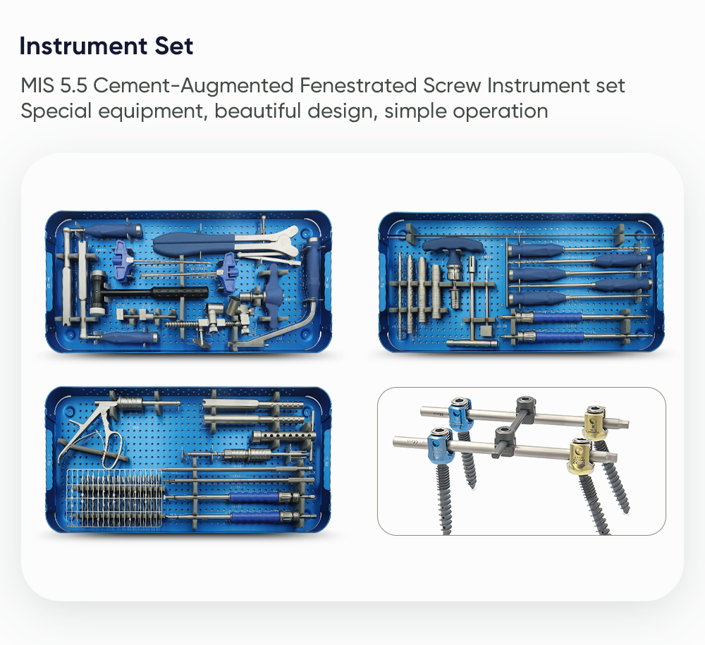 MIS 5.5 окончатый винт, усиленный цементом 