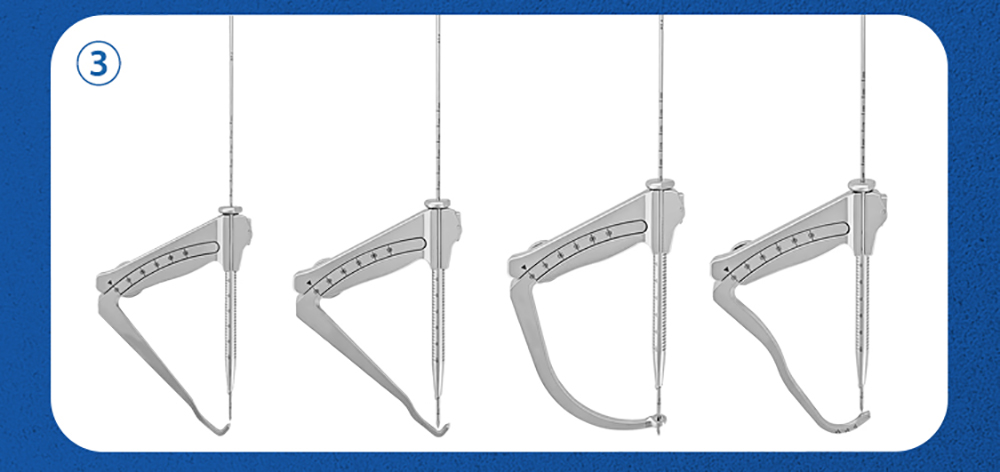 Набор инструментов для локализации крестообразной связки XC Medico - 