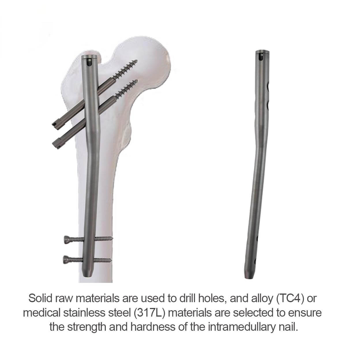 Гамма-интрамедуллярный стержень-2