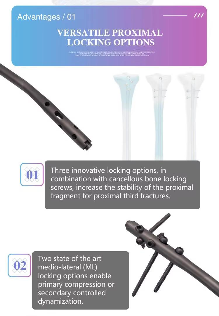 Большеберцовая кость, интрамедиально, гвоздь-2