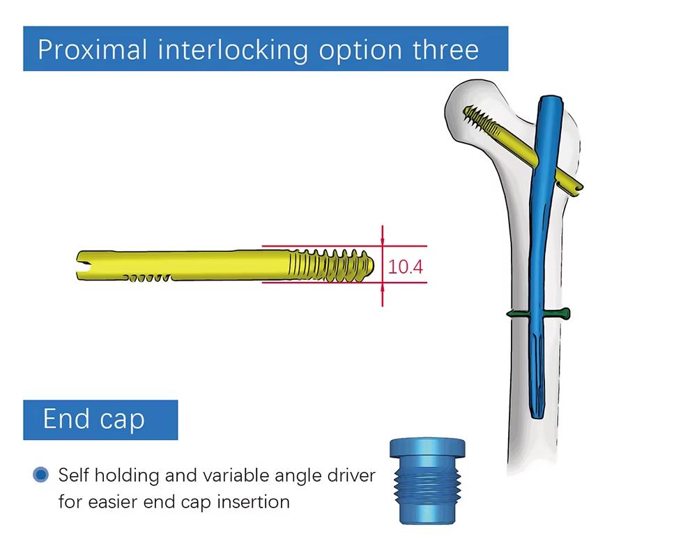 Бедренный интрамедуллярный стержень-6