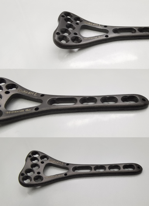 Фиксирующая пластина дистального радиуса (7 отверстий)-3