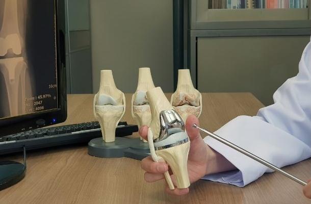 Hip and knee joints.jpg