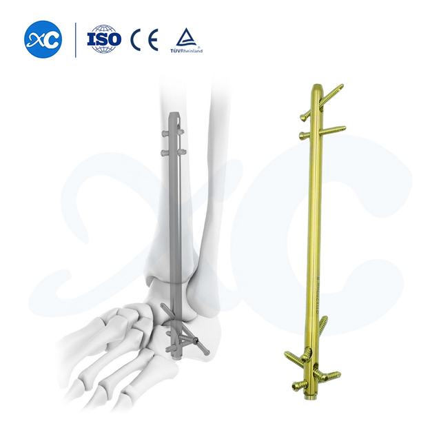 Гвоздь для лодыжки Fusion на задней стопе