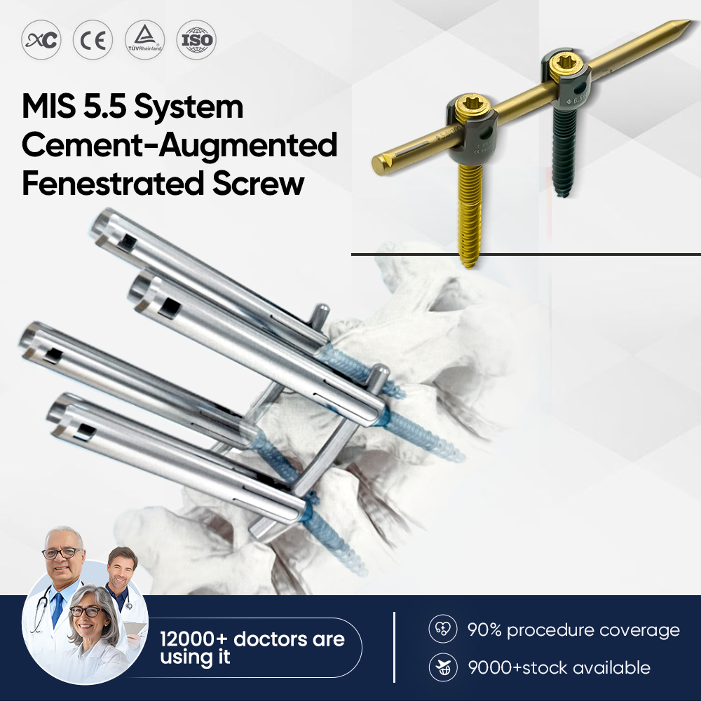 MIS 5.5 окончатый винт, усиленный цементом 