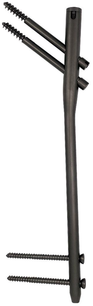 Гамма-интрамедуллярный стержень-5