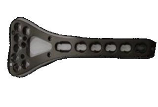 Фиксирующая пластина дистального радиуса (7 отверстий)