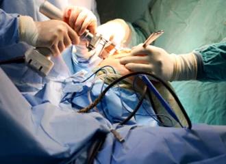 медицинский электроинструмент Banner-2