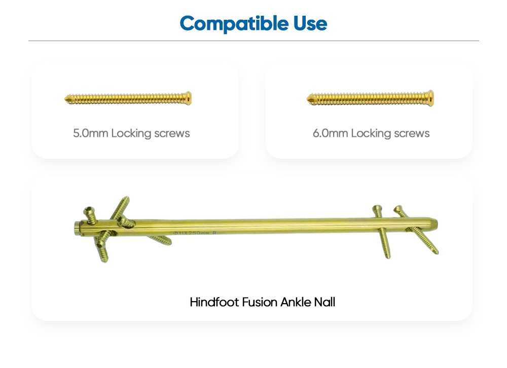 Набор инструментов для ногтей на лодыжке Hindfoot Fusion — покупка на XC Medico