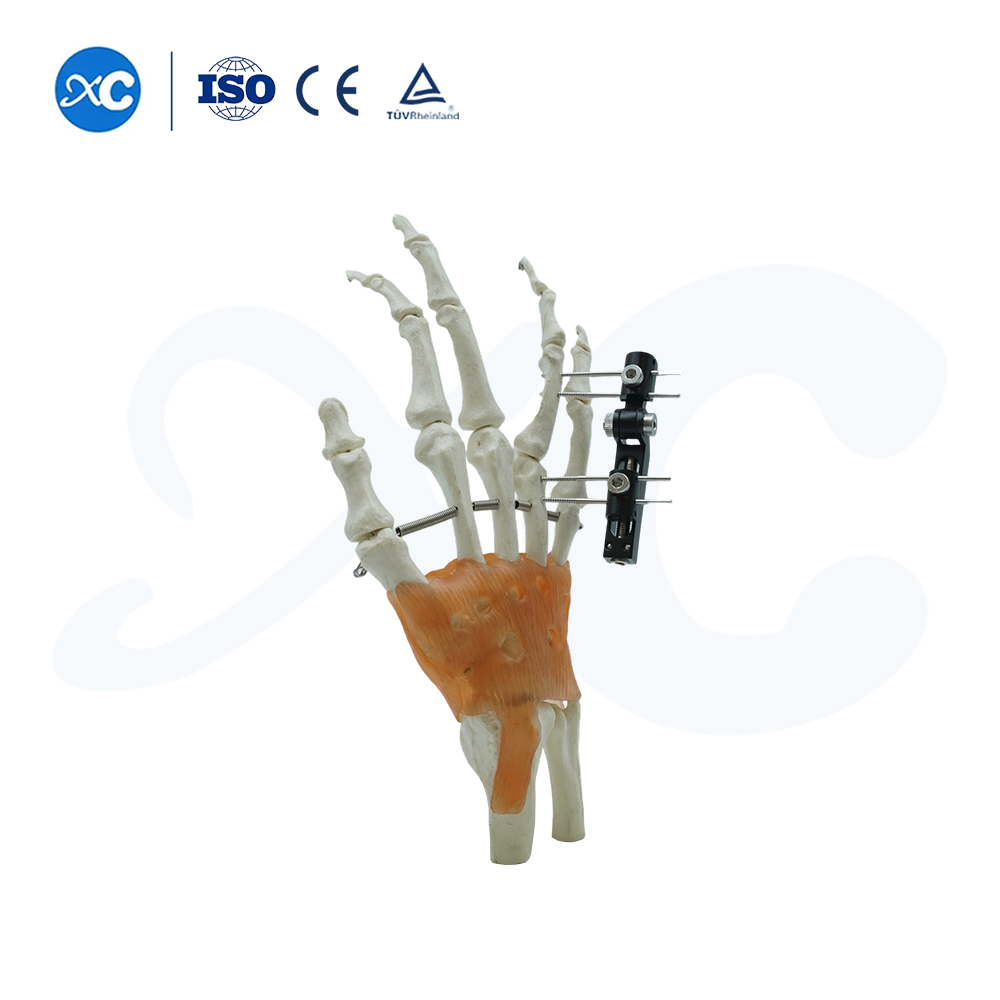 Мини-фиксатор с вертикальной осью