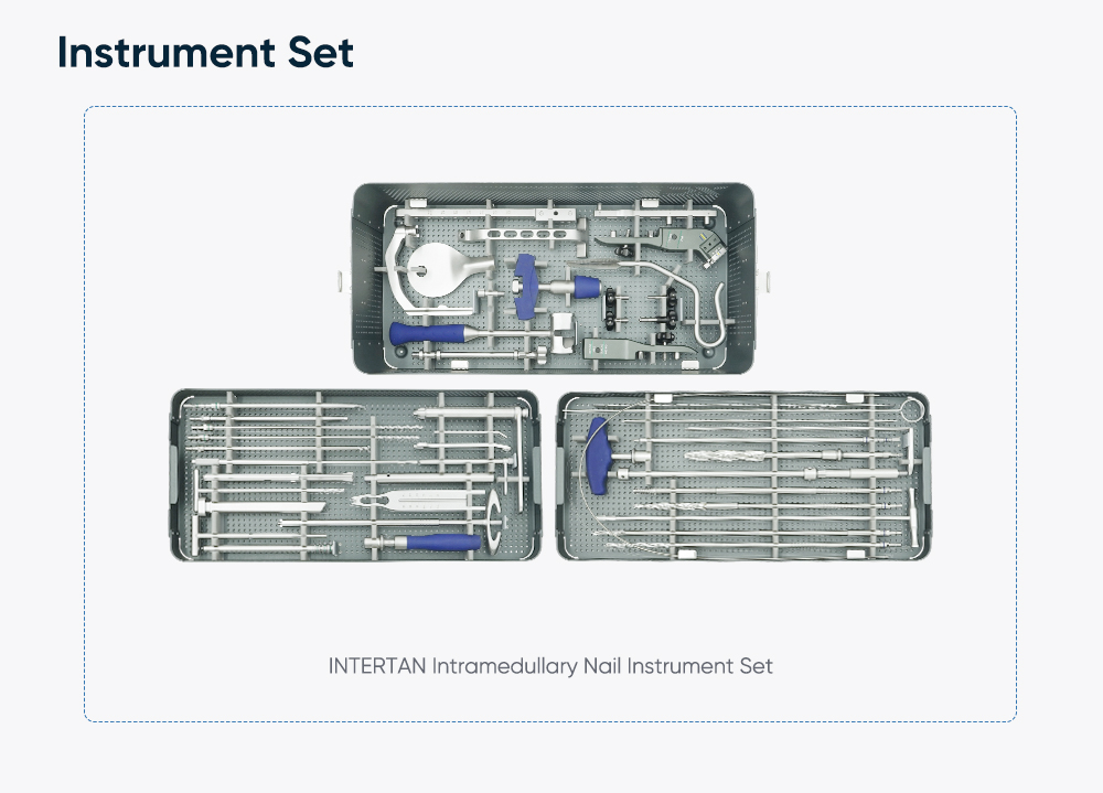 Система интрамедуллярных стержней Intertan – фиксация перелома проксимального отдела бедренной кости
