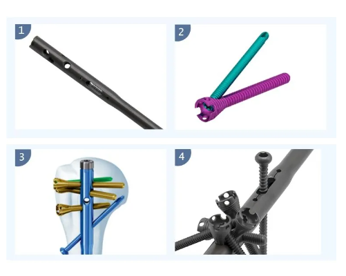 Интрамедуллярный гвоздь плечевой кости Multi Lock-3