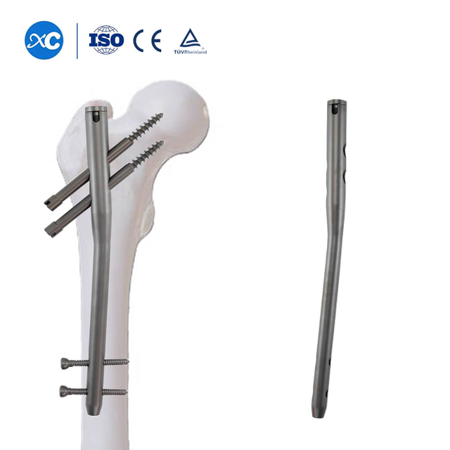 Реконструкция бедренной кости Интрамедуллярный гвоздь-короткий