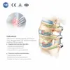 Набор инструментов MIS Spinal Portal для минимально инвазивной хирургии позвоночника