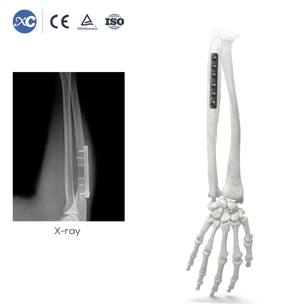 Набор инструментов для фиксации небольших фрагментов