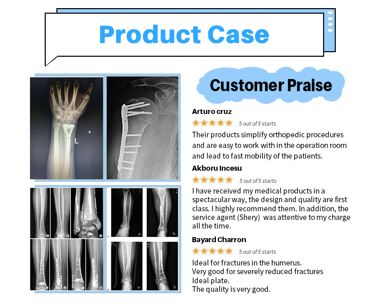 Фиксирующая пластина ключицы_04