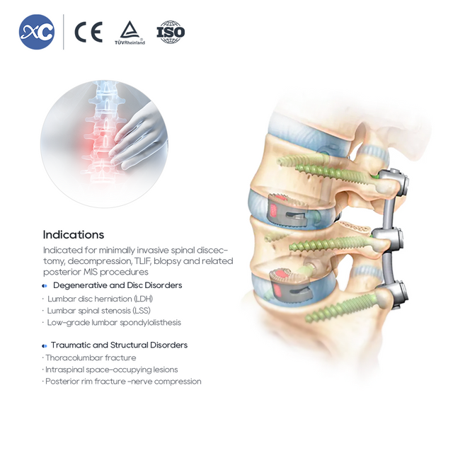 Набор инструментов MIS Spinal Portal