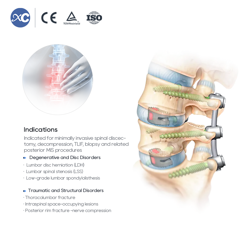 Набор инструментов MIS Spinal Portal