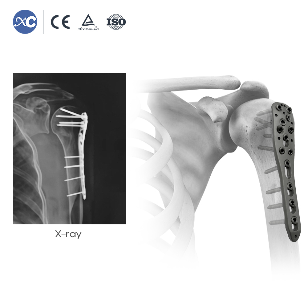 Набор инструментов для мелких фрагментов (2,7/3,5 мм)
