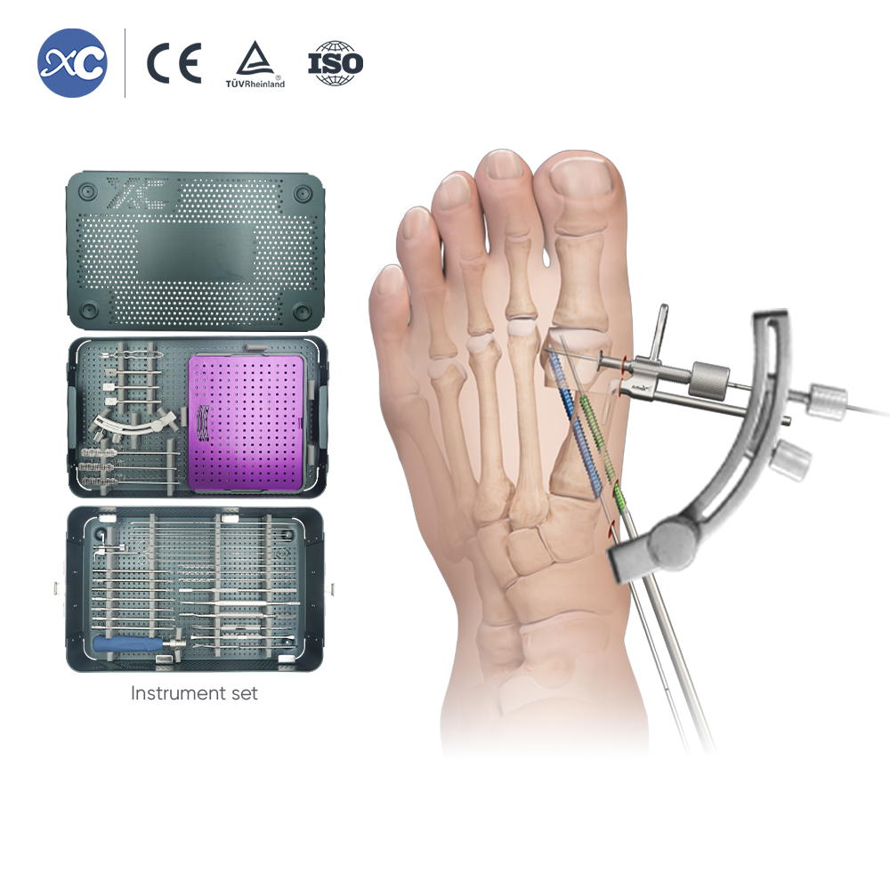 Набор инструментов для остеотомии Hallux Valgus MIS