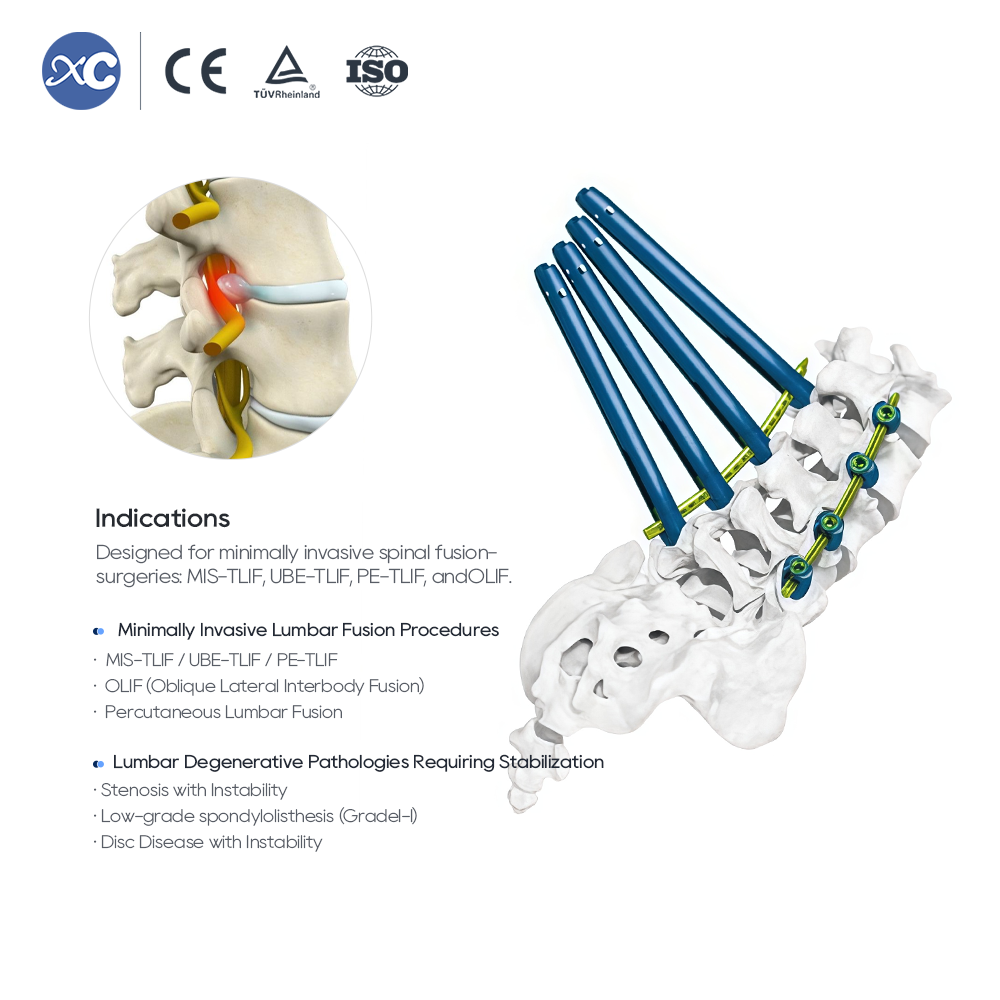 5.5 Набор инструментов MIS Spinal System II