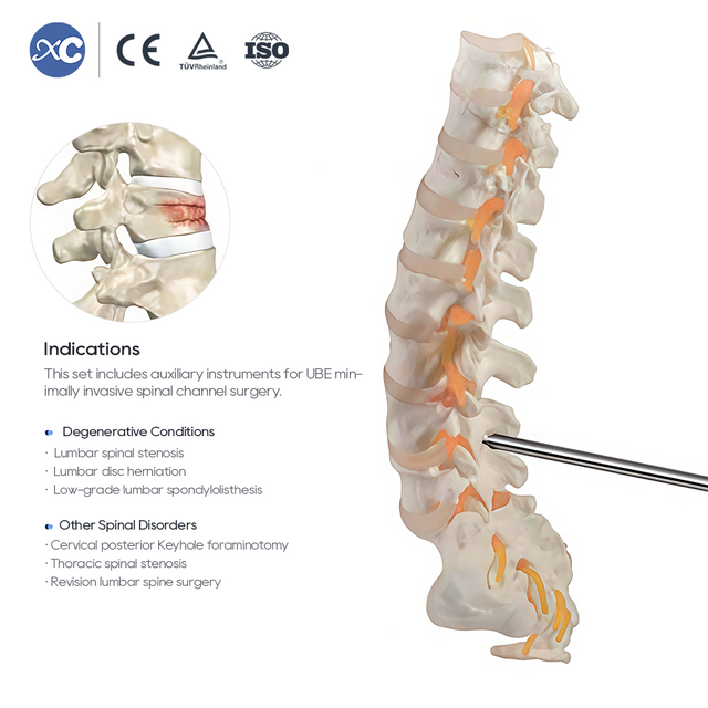 Набор инструментов для хирургии позвоночника UBE