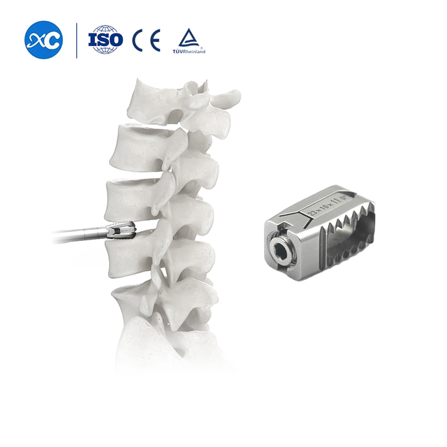 Расширяемая клетка PVE — поясничный межтеловой имплантат для MIS-TLIF и UBE