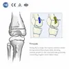 Набор ортопедических инструментов для детей Valgus Varus