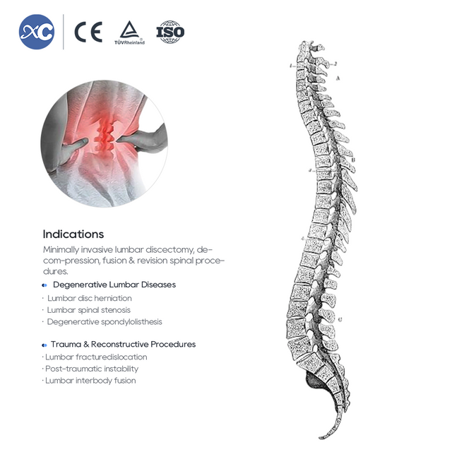 Набор инструментов для шарнирного ретрактора MLD
