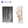 Набор инструментов для остеотомии Hallux Valgus MIS