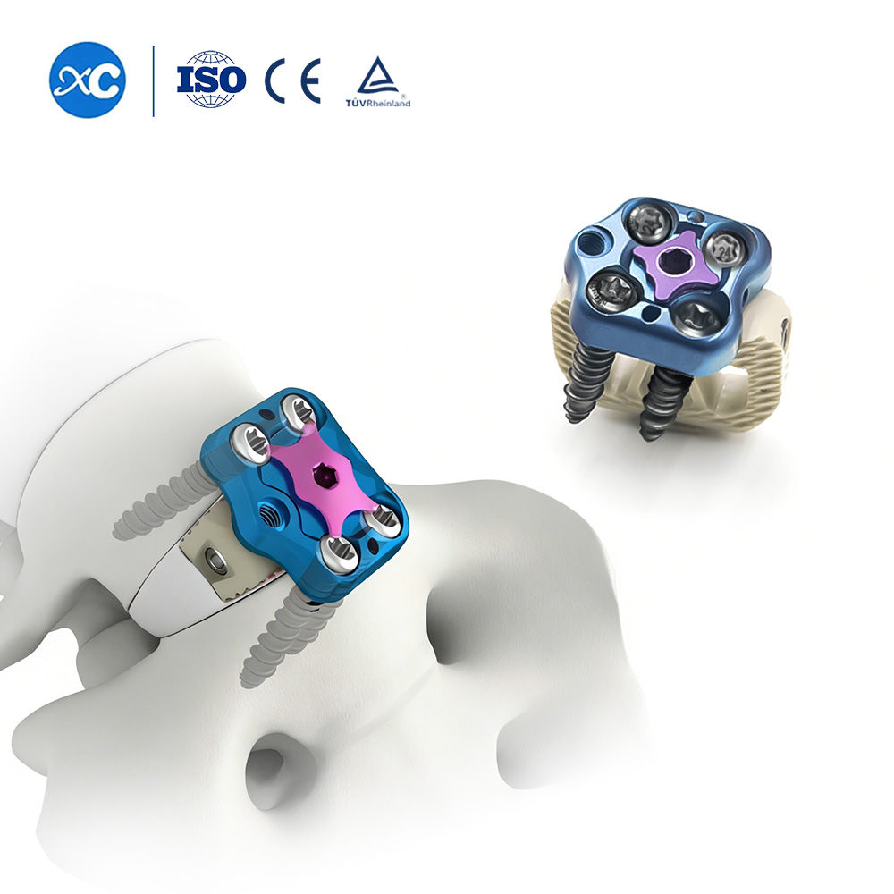 Система пластин ALIF Cage и ATLPS — передний поясничный межтеловой спондилодезный имплантат