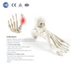 Набор инструментов для остеотомии Hallux Valgus MIS