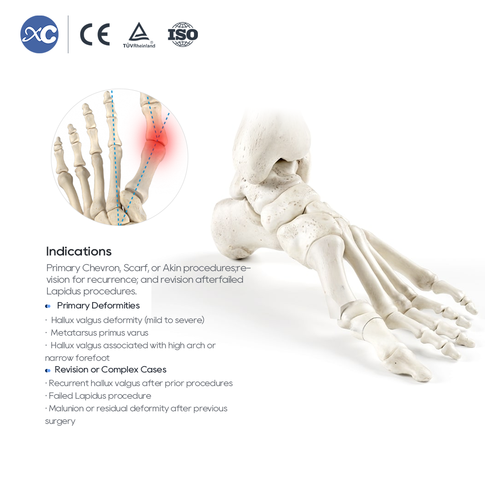 Набор инструментов для остеотомии Hallux Valgus MIS