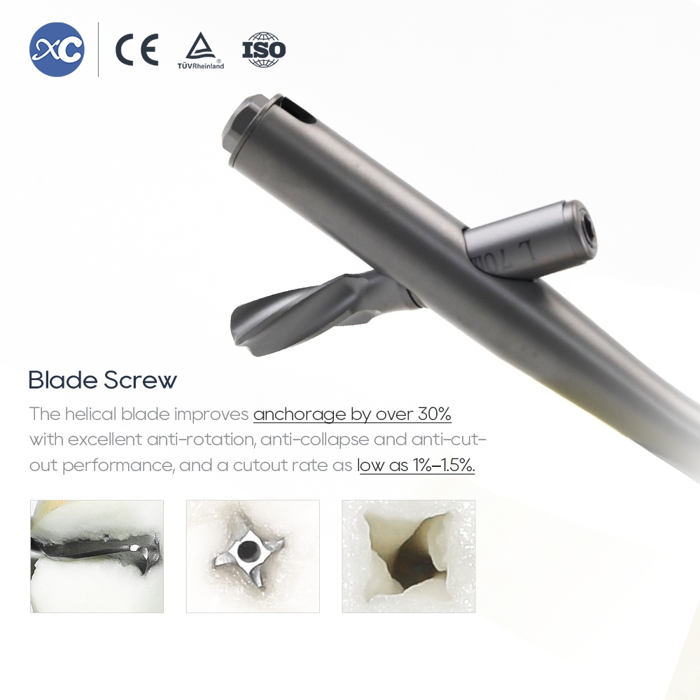 Интрамедуллярный гвоздь PFNA