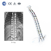 Набор инструментов MIS Spinal Portal