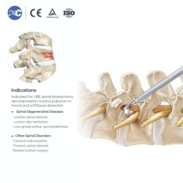 Набор инструментов UBE для ламинэктомии и щипцов для гипофиза