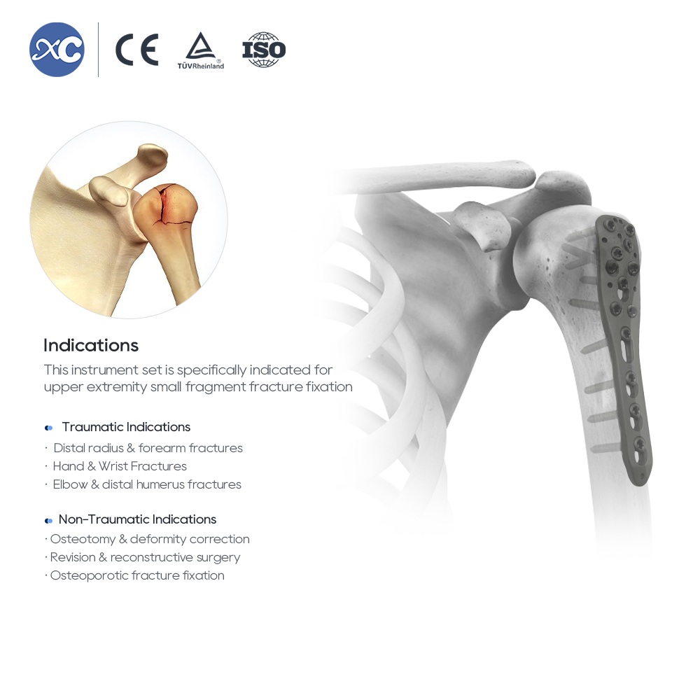 Набор инструментов для фиксации небольших фрагментов
